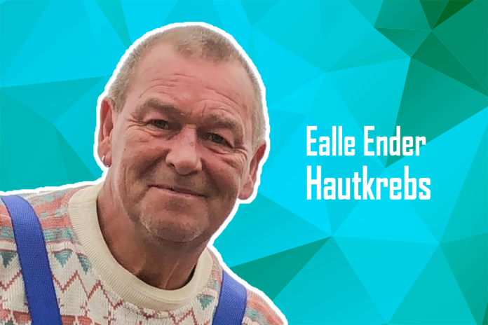 Ealle Ender Hautkrebs