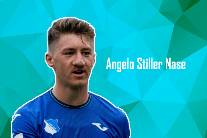 Angelo Stiller Nase